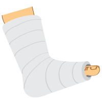 Plantar Fasciitis | What is Plantar Fasciitis?