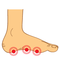 Functional Orthotic